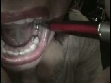 Unção do Dente de Ouro